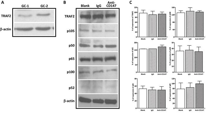 https://cdn.ncbi.nlm.nih.gov/pmc/blobs/b360/5356870/aa231f7abab3/oncotarget-08-3132-g005.jpg