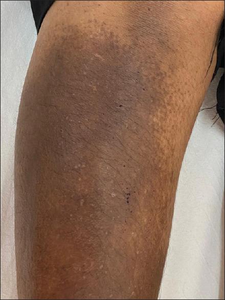https://cdn.ncbi.nlm.nih.gov/pmc/blobs/b361/10238991/fa42f9271cfa/IJD-68-205-g007.jpg
