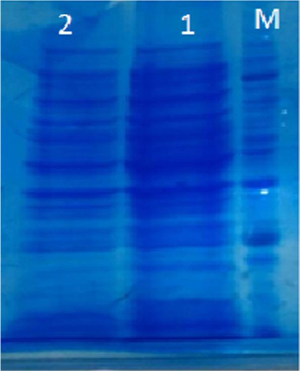 https://cdn.ncbi.nlm.nih.gov/pmc/blobs/b362/7867700/4a1543c4e424/IJM-12-417-g001.jpg