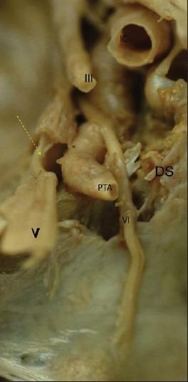 https://cdn.ncbi.nlm.nih.gov/pmc/blobs/b366/3475875/23c576e91f4e/SNI-3-111-g002.jpg