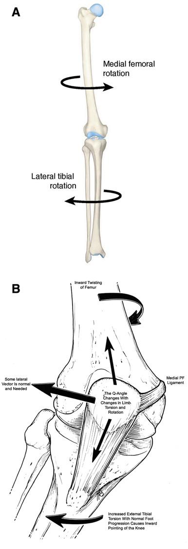 https://cdn.ncbi.nlm.nih.gov/pmc/blobs/b368/3445137/2d35b75908e2/10.1177_1941738111399372-fig2.jpg