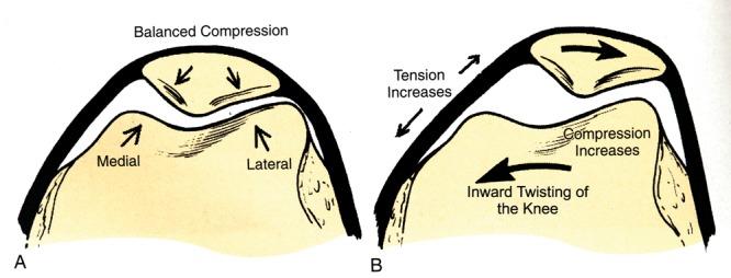 https://cdn.ncbi.nlm.nih.gov/pmc/blobs/b368/3445137/58991721f256/10.1177_1941738111399372-fig3.jpg