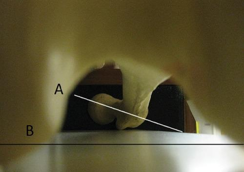 https://cdn.ncbi.nlm.nih.gov/pmc/blobs/b368/3445137/84756c3b5d63/10.1177_1941738111399372-fig4.jpg
