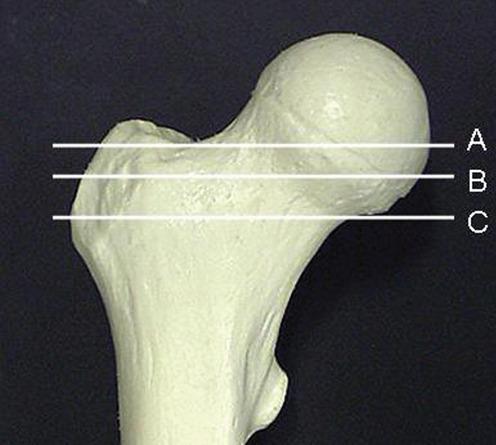 https://cdn.ncbi.nlm.nih.gov/pmc/blobs/b368/3445137/880ca945bea8/10.1177_1941738111399372-fig8.jpg