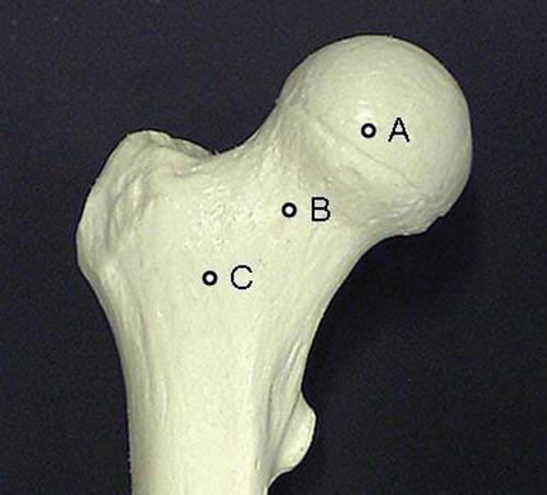 https://cdn.ncbi.nlm.nih.gov/pmc/blobs/b368/3445137/bf164c4369a4/10.1177_1941738111399372-fig9.jpg