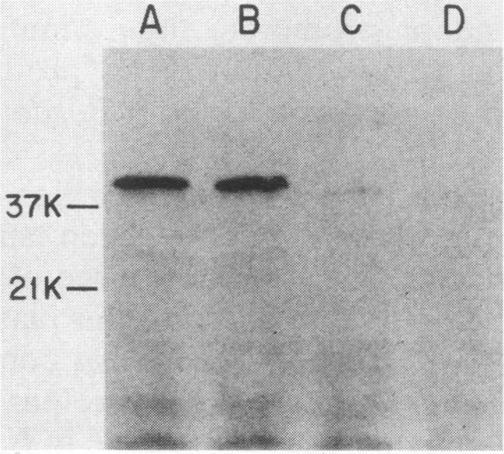 https://cdn.ncbi.nlm.nih.gov/pmc/blobs/b36b/260508/339faac3f15d/iai00089-0312-c.jpg