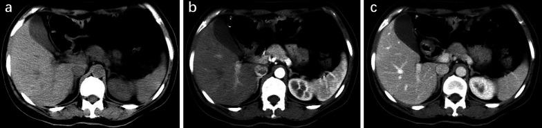 https://cdn.ncbi.nlm.nih.gov/pmc/blobs/b36b/9871080/803f08acd9de/13244_2023_1366_Fig2_HTML.jpg