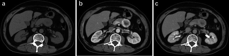 https://cdn.ncbi.nlm.nih.gov/pmc/blobs/b36b/9871080/c40feb113b18/13244_2023_1366_Fig4_HTML.jpg