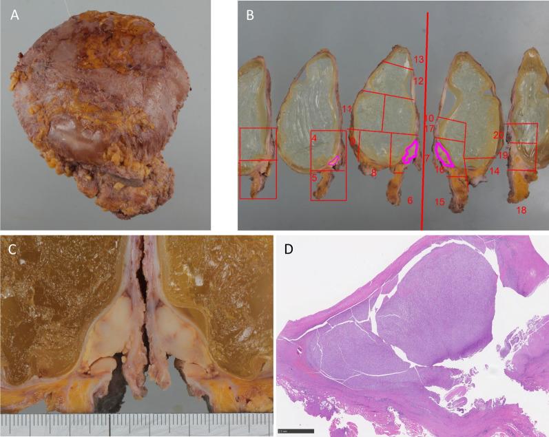 https://cdn.ncbi.nlm.nih.gov/pmc/blobs/b36c/11343931/015d8c304993/40792_2024_1996_Fig6_HTML.jpg