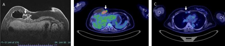 https://cdn.ncbi.nlm.nih.gov/pmc/blobs/b36c/11343931/06b574c331de/40792_2024_1996_Fig4_HTML.jpg