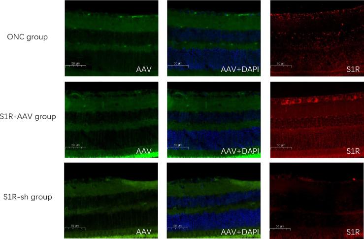 https://cdn.ncbi.nlm.nih.gov/pmc/blobs/b375/10484044/a1670f71be28/iovs-64-12-9-f002.jpg