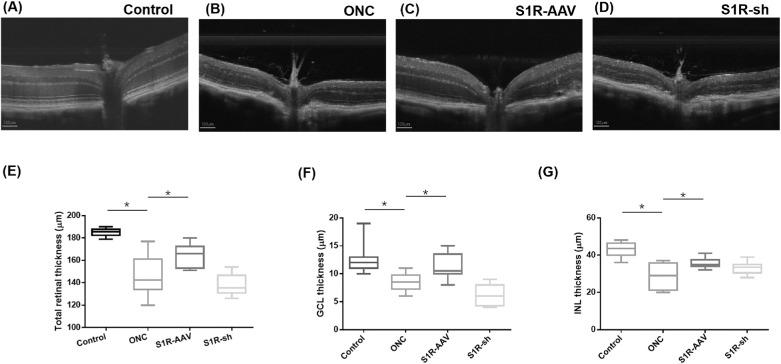 https://cdn.ncbi.nlm.nih.gov/pmc/blobs/b375/10484044/a5a039a2d19b/iovs-64-12-9-f003.jpg