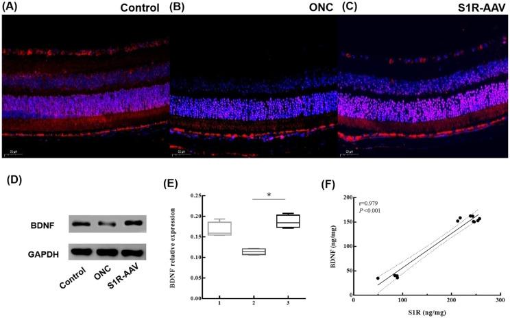 https://cdn.ncbi.nlm.nih.gov/pmc/blobs/b375/10484044/b0d543a7b2c7/iovs-64-12-9-f006.jpg