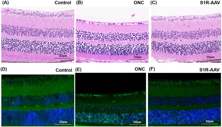 https://cdn.ncbi.nlm.nih.gov/pmc/blobs/b375/10484044/f0937ddd32f4/iovs-64-12-9-f004.jpg
