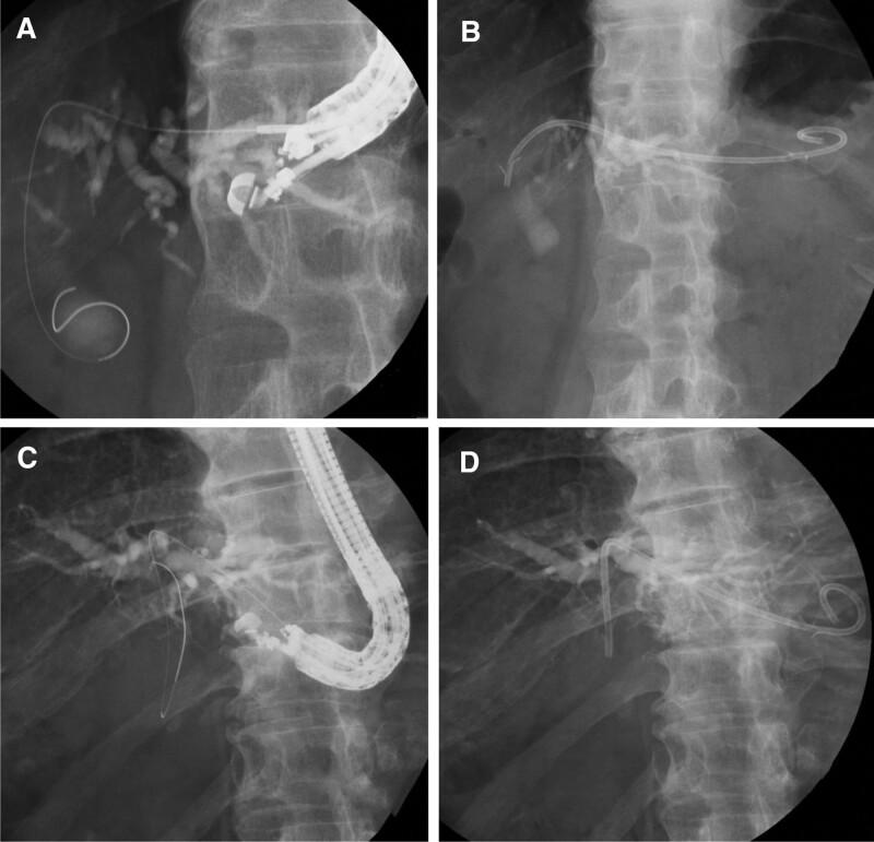 https://cdn.ncbi.nlm.nih.gov/pmc/blobs/b383/9646514/c349237fcd05/medi-101-e31545-g001.jpg