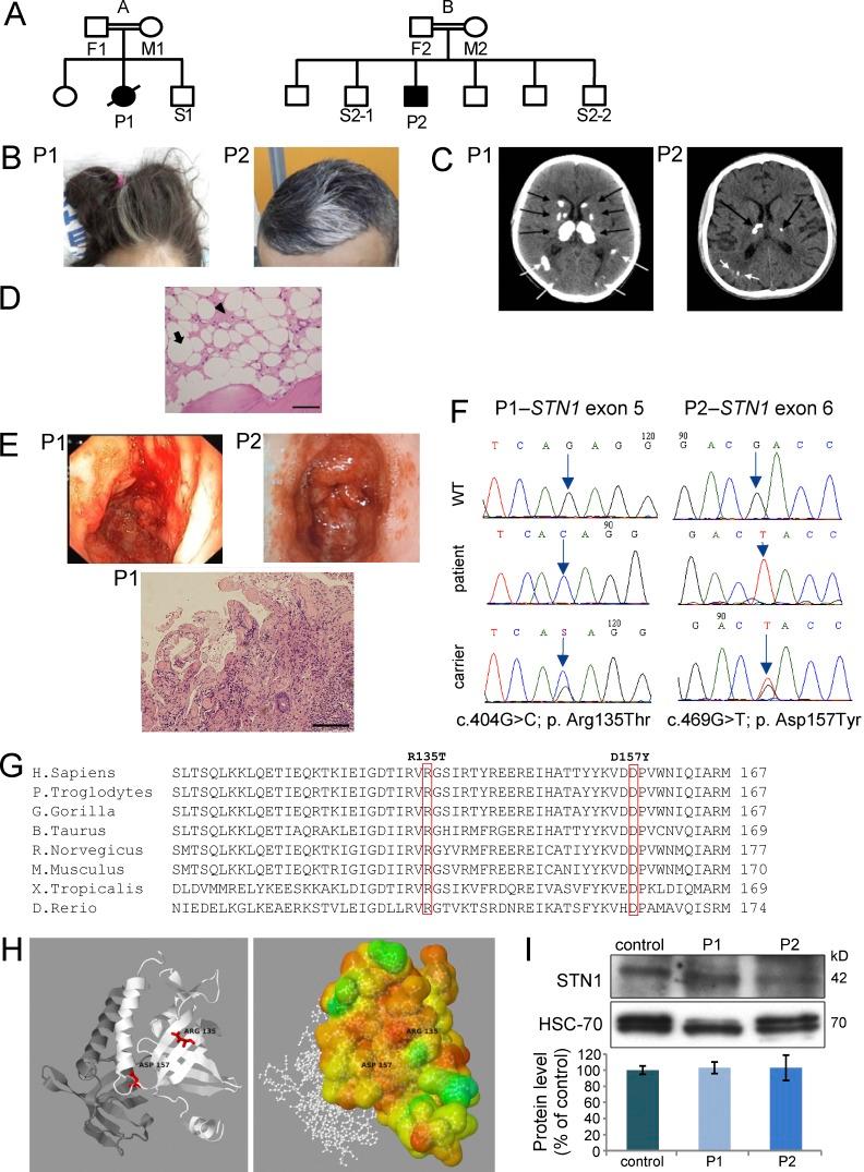 https://cdn.ncbi.nlm.nih.gov/pmc/blobs/b390/4986528/f2d46456f754/JEM_20151618_Fig1.jpg