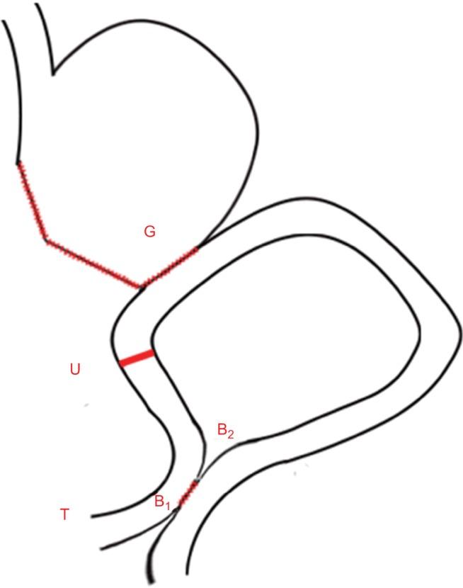 https://cdn.ncbi.nlm.nih.gov/pmc/blobs/b394/6389003/7ca492b5fc9a/cmar-11-1697Fig2.jpg