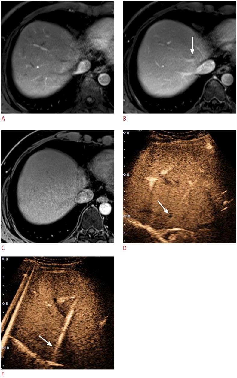 https://cdn.ncbi.nlm.nih.gov/pmc/blobs/b398/11717683/b866909ad479/usg-24163f5.jpg