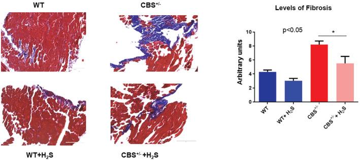 https://cdn.ncbi.nlm.nih.gov/pmc/blobs/b398/9391604/5b39264fb5e1/PHY2-10-e15422-g002.jpg