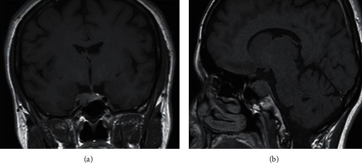 https://cdn.ncbi.nlm.nih.gov/pmc/blobs/b39f/7899752/a707a01dc28b/CRIE2021-5517303.003.jpg