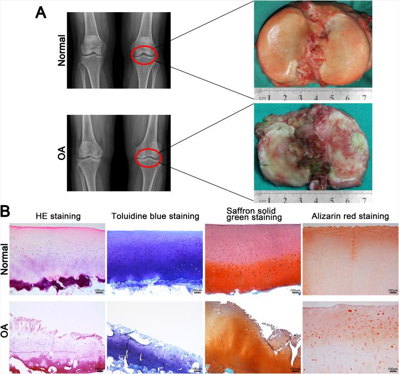 https://cdn.ncbi.nlm.nih.gov/pmc/blobs/b39f/8720673/e6928162afda/gr1.jpg