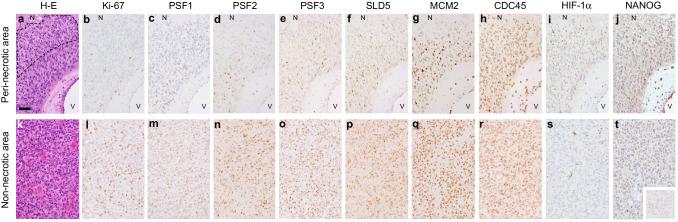 https://cdn.ncbi.nlm.nih.gov/pmc/blobs/b3a0/11810424/064997094e13/432_2018_2797_Fig1_HTML.jpg
