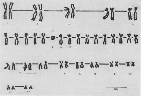 https://cdn.ncbi.nlm.nih.gov/pmc/blobs/b3a3/1468560/1a80a1e68189/jmedgene00383-0072-a.jpg