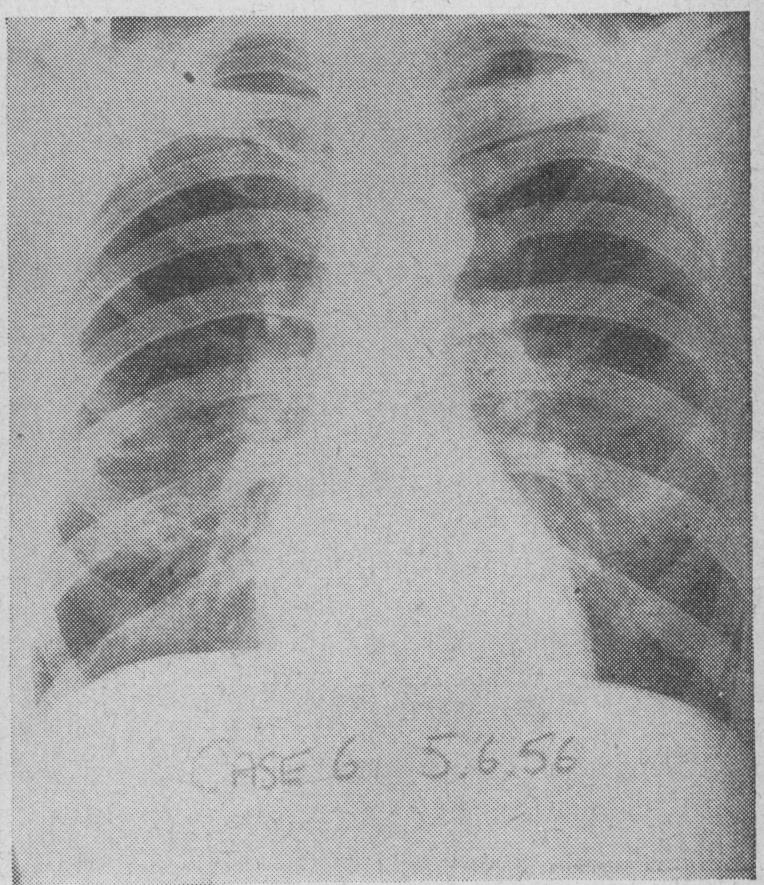 https://cdn.ncbi.nlm.nih.gov/pmc/blobs/b3a3/2166064/62c951a9c612/brmedj02394-0037-b.jpg