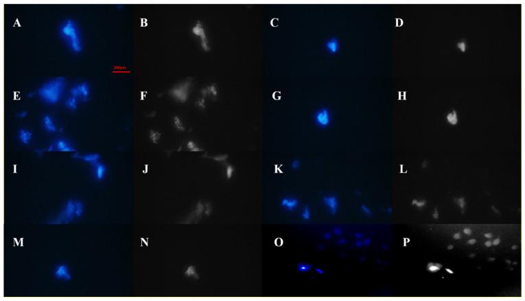 https://cdn.ncbi.nlm.nih.gov/pmc/blobs/b3a6/8615380/5a926b9d9339/biomolecules-11-01714-g007.jpg