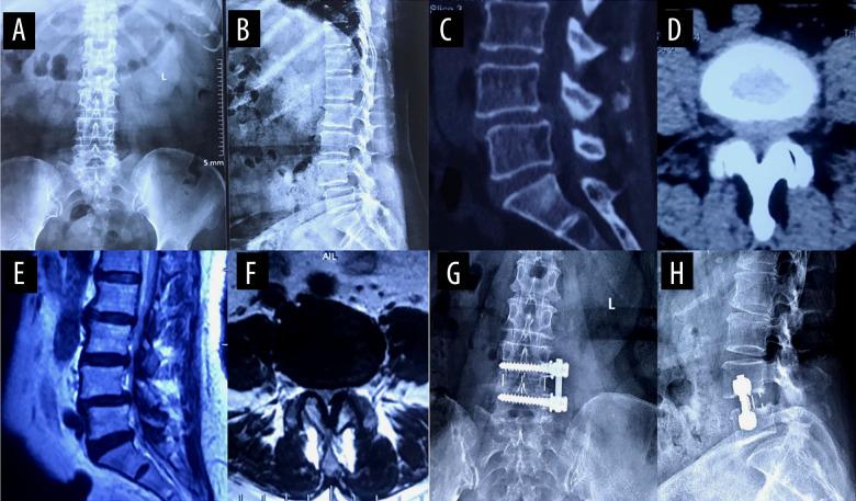 https://cdn.ncbi.nlm.nih.gov/pmc/blobs/b3a9/8753906/63c902e98967/medscimonit-28-e934985-g005.jpg