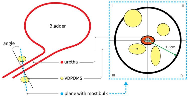 https://cdn.ncbi.nlm.nih.gov/pmc/blobs/b3ac/8842146/831376dd3b9f/10.1177_17562872211060909-fig3.jpg