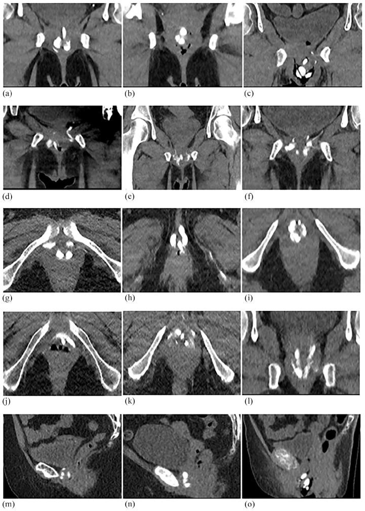 https://cdn.ncbi.nlm.nih.gov/pmc/blobs/b3ac/8842146/b3e64471d4a9/10.1177_17562872211060909-fig4.jpg