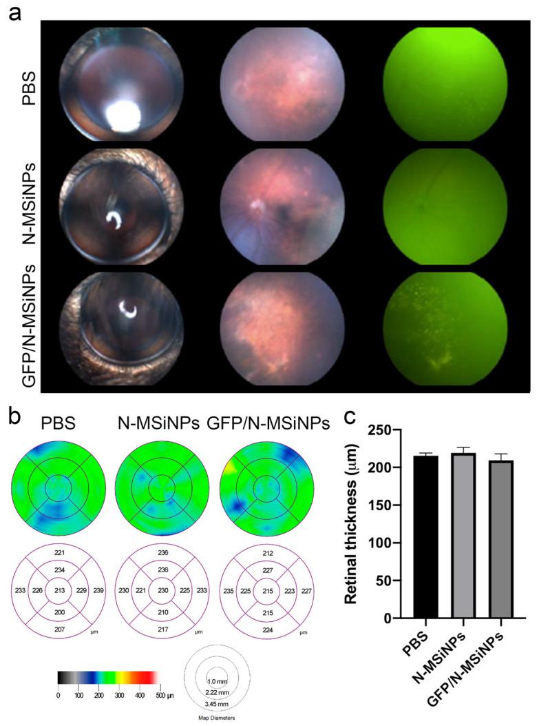 https://cdn.ncbi.nlm.nih.gov/pmc/blobs/b3b8/9026300/d700a76cb2af/jcm-11-02170-g003.jpg