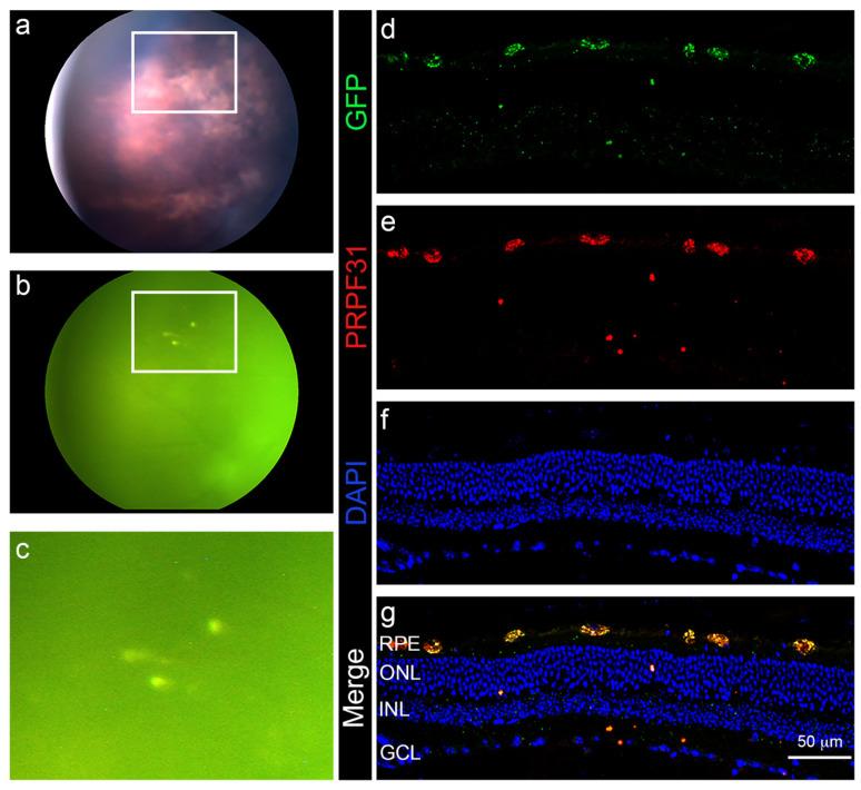 https://cdn.ncbi.nlm.nih.gov/pmc/blobs/b3b8/9026300/e0cf895b46f7/jcm-11-02170-g006.jpg