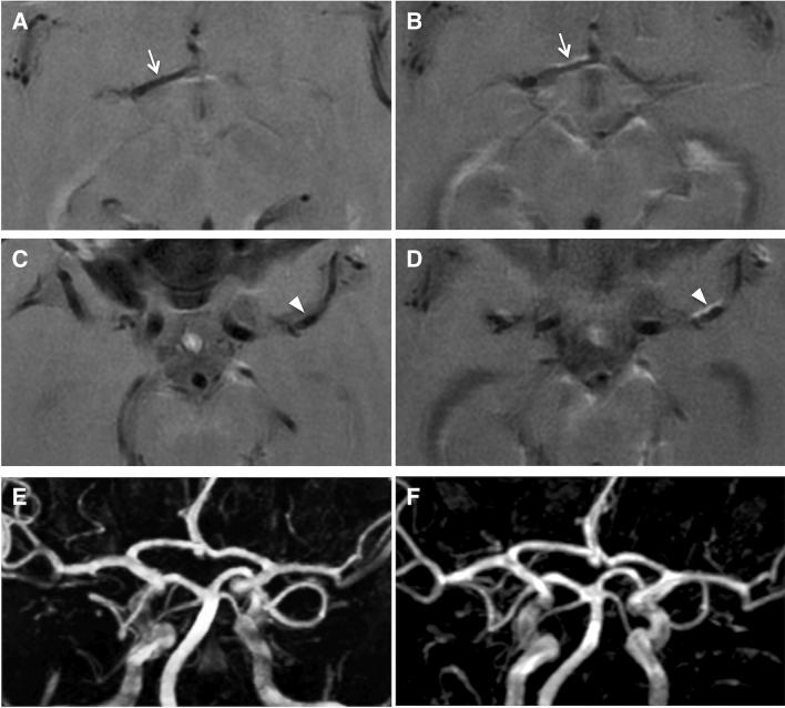 https://cdn.ncbi.nlm.nih.gov/pmc/blobs/b3bc/8782817/5340f24015f6/415_2021_10683_Fig5_HTML.jpg