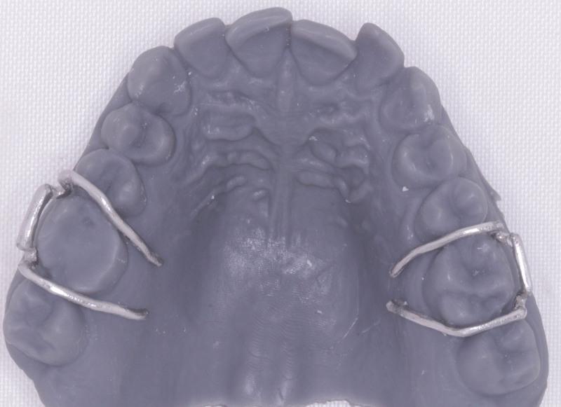 https://cdn.ncbi.nlm.nih.gov/pmc/blobs/b3c2/11049687/a105014f4166/medi-103-e38004-g012.jpg