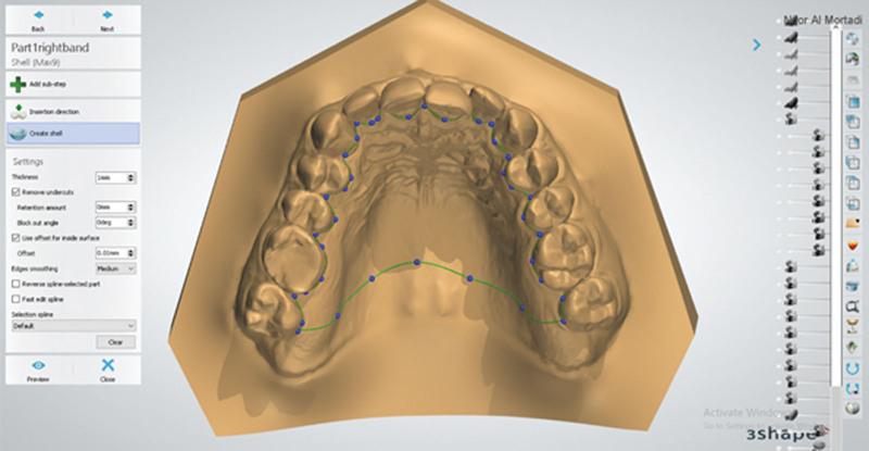 https://cdn.ncbi.nlm.nih.gov/pmc/blobs/b3c2/11049687/cd04bfde3b77/medi-103-e38004-g003.jpg