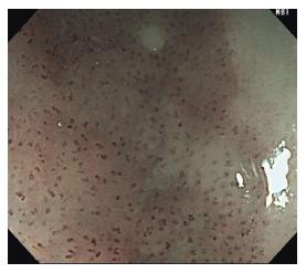 https://cdn.ncbi.nlm.nih.gov/pmc/blobs/b3c7/5605343/2ba50fdab5d3/WJGE-9-438-g004.jpg