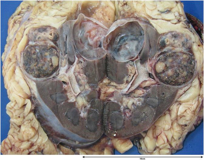 https://cdn.ncbi.nlm.nih.gov/pmc/blobs/b3c8/6971347/a484b997e5d0/gr2.jpg