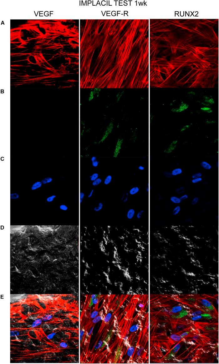 https://cdn.ncbi.nlm.nih.gov/pmc/blobs/b3cb/7240029/319fa4914ffc/fcell-08-00315-g009.jpg