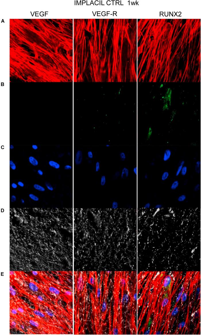 https://cdn.ncbi.nlm.nih.gov/pmc/blobs/b3cb/7240029/932fb6d902ab/fcell-08-00315-g007.jpg