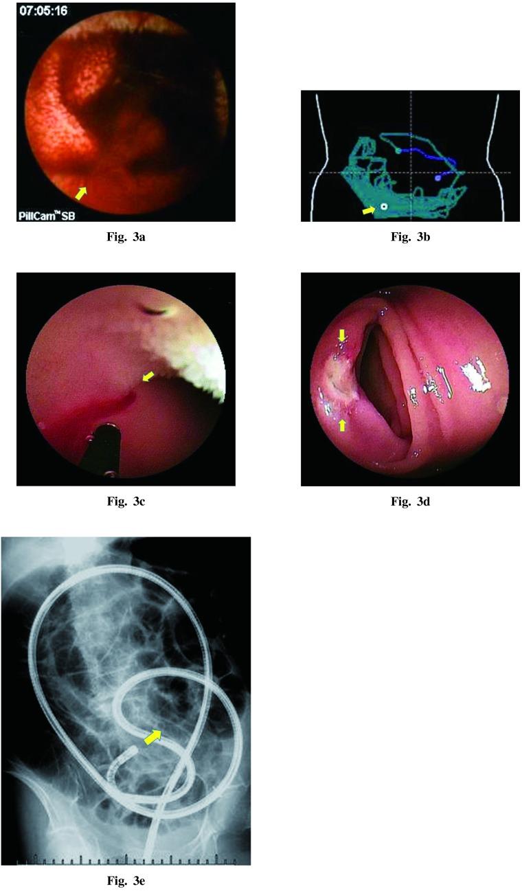 https://cdn.ncbi.nlm.nih.gov/pmc/blobs/b3d1/4345683/e6cc5448fc59/2186-3326-76-369-g003.jpg