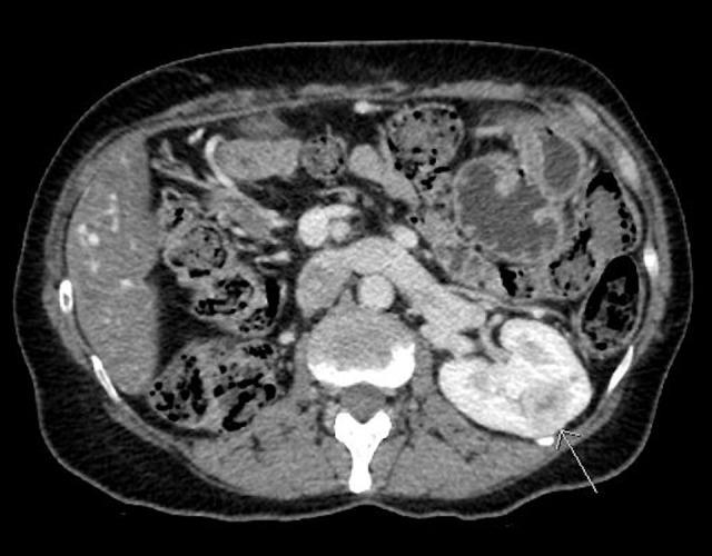 https://cdn.ncbi.nlm.nih.gov/pmc/blobs/b3da/8112462/af5c22092b3b/amjcaserep-22-e931696-g001.jpg