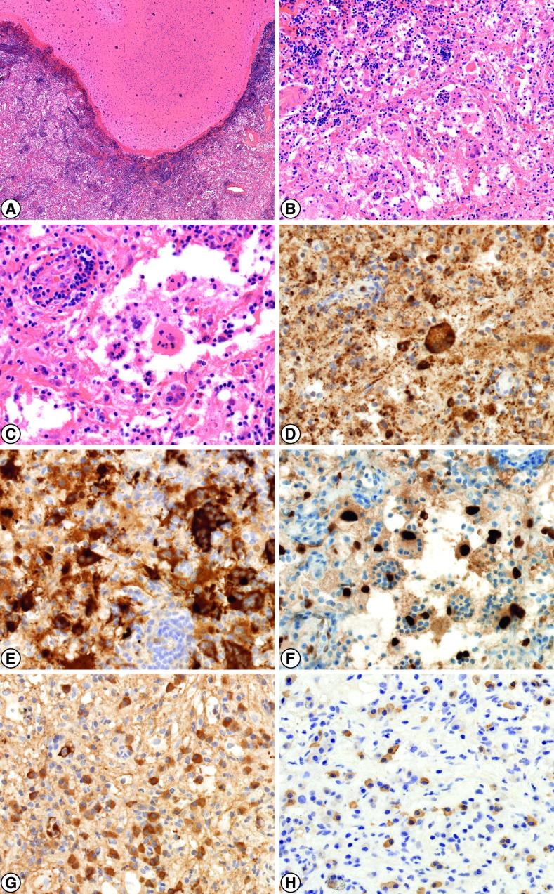 https://cdn.ncbi.nlm.nih.gov/pmc/blobs/b3df/10701702/0b95cf7aab94/cns-12-103-g1.jpg