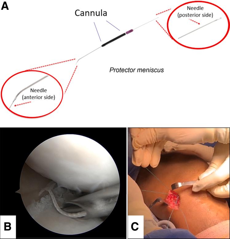 https://cdn.ncbi.nlm.nih.gov/pmc/blobs/b3e6/11551364/704b193b6262/gr1.jpg