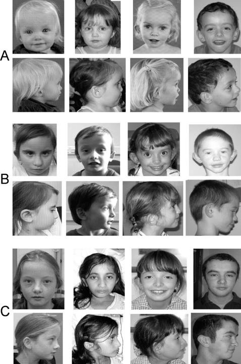 https://cdn.ncbi.nlm.nih.gov/pmc/blobs/b3eb/2976034/d2087b959747/jmedgenet79111fig2.jpg