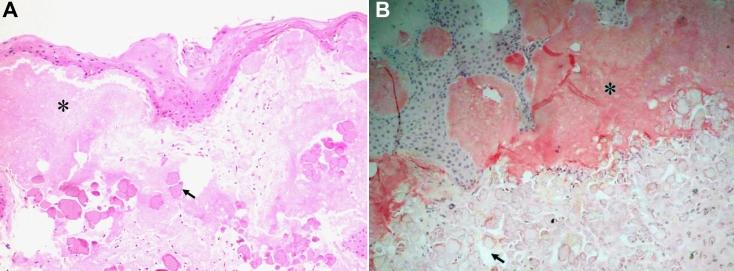 https://cdn.ncbi.nlm.nih.gov/pmc/blobs/b3ef/2927379/1579513c2e93/mv-v16-1570-f4.jpg