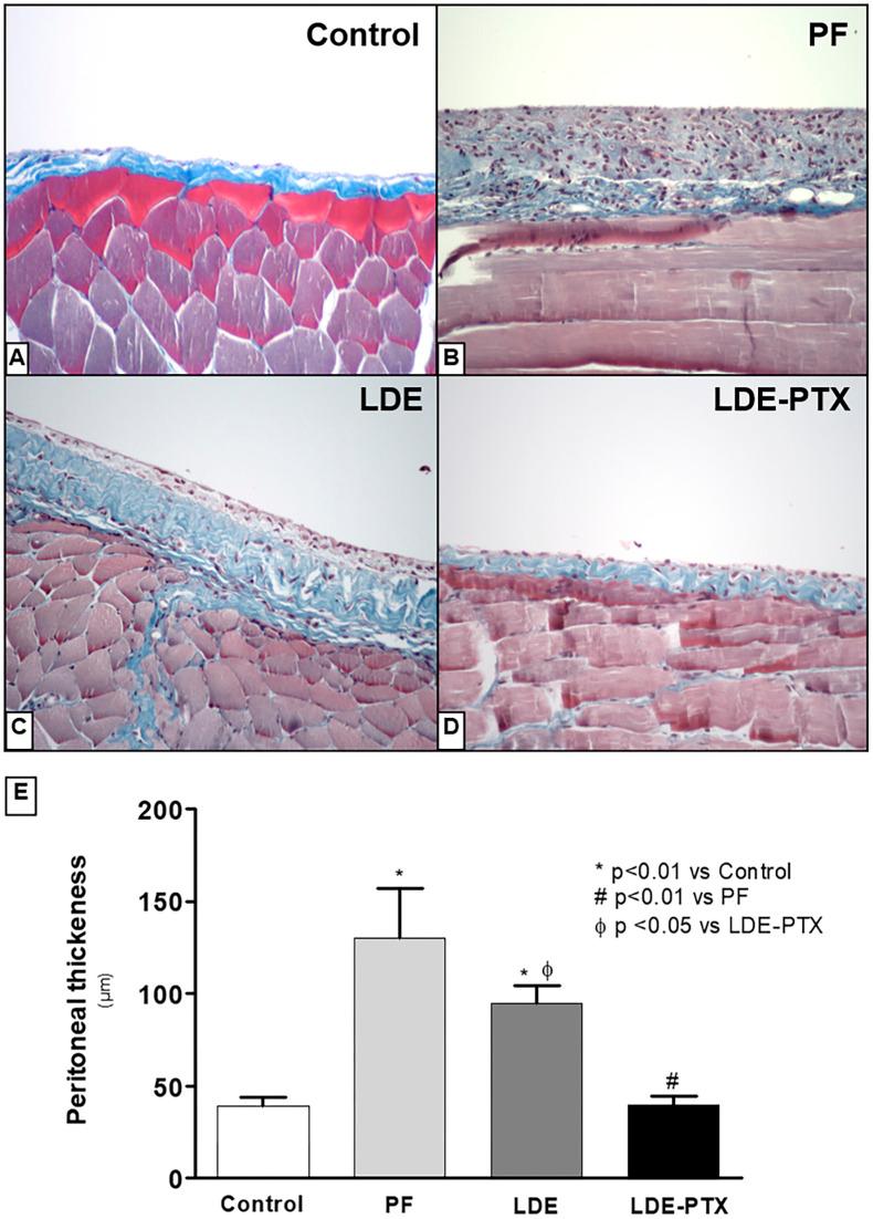 https://cdn.ncbi.nlm.nih.gov/pmc/blobs/b3f5/9075628/813c7343d69b/pone.0268197.g002.jpg