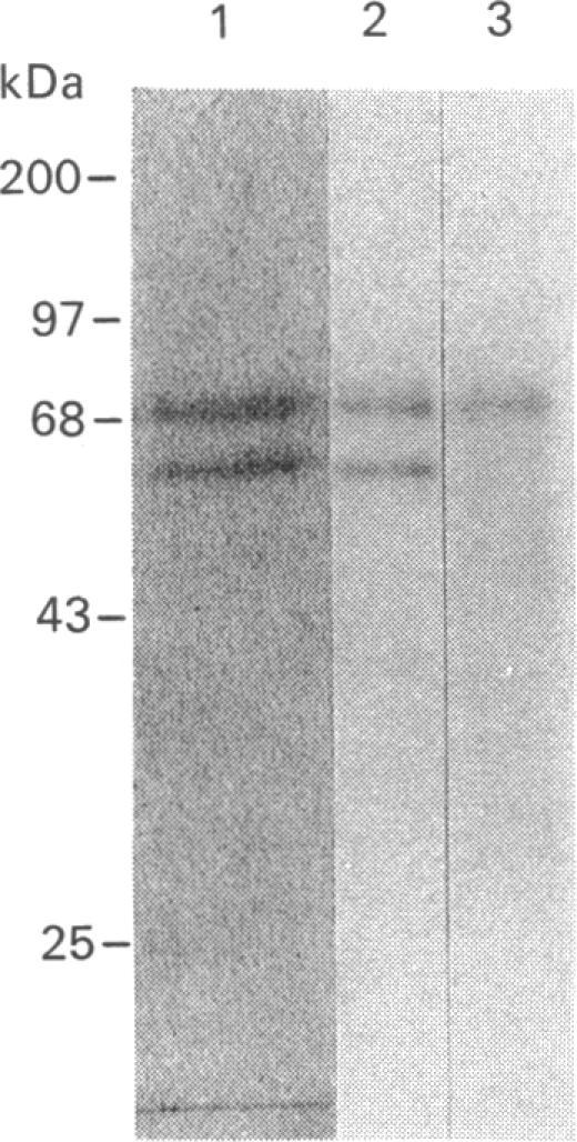 https://cdn.ncbi.nlm.nih.gov/pmc/blobs/b3f9/1149972/32fa0e945015/biochemj00163-0111-a.jpg