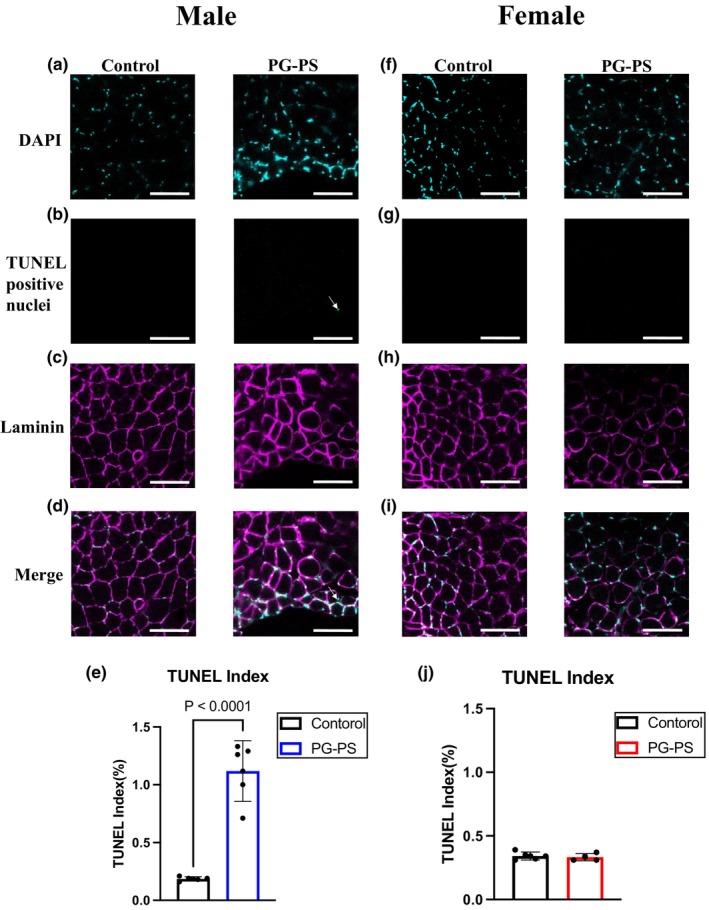 https://cdn.ncbi.nlm.nih.gov/pmc/blobs/b3fd/12181685/f89b4c71dae9/PHY2-13-e70431-g005.jpg